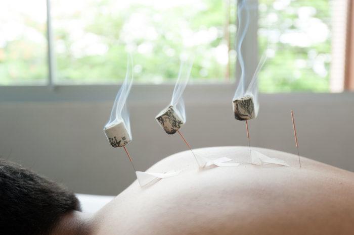 La moxibustion à Genève